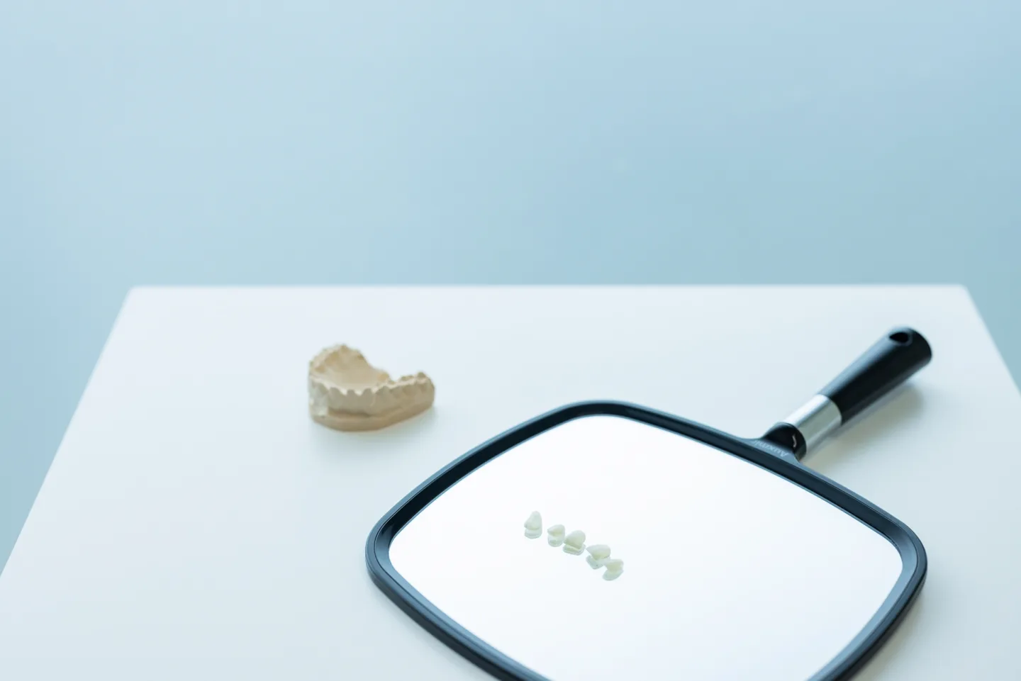 Calco dell'arcata dentale superiore utilizzato per le faccette dentali e l'estetica del sorriso allo Studio Redolfi, dentista a Flero e Brescia